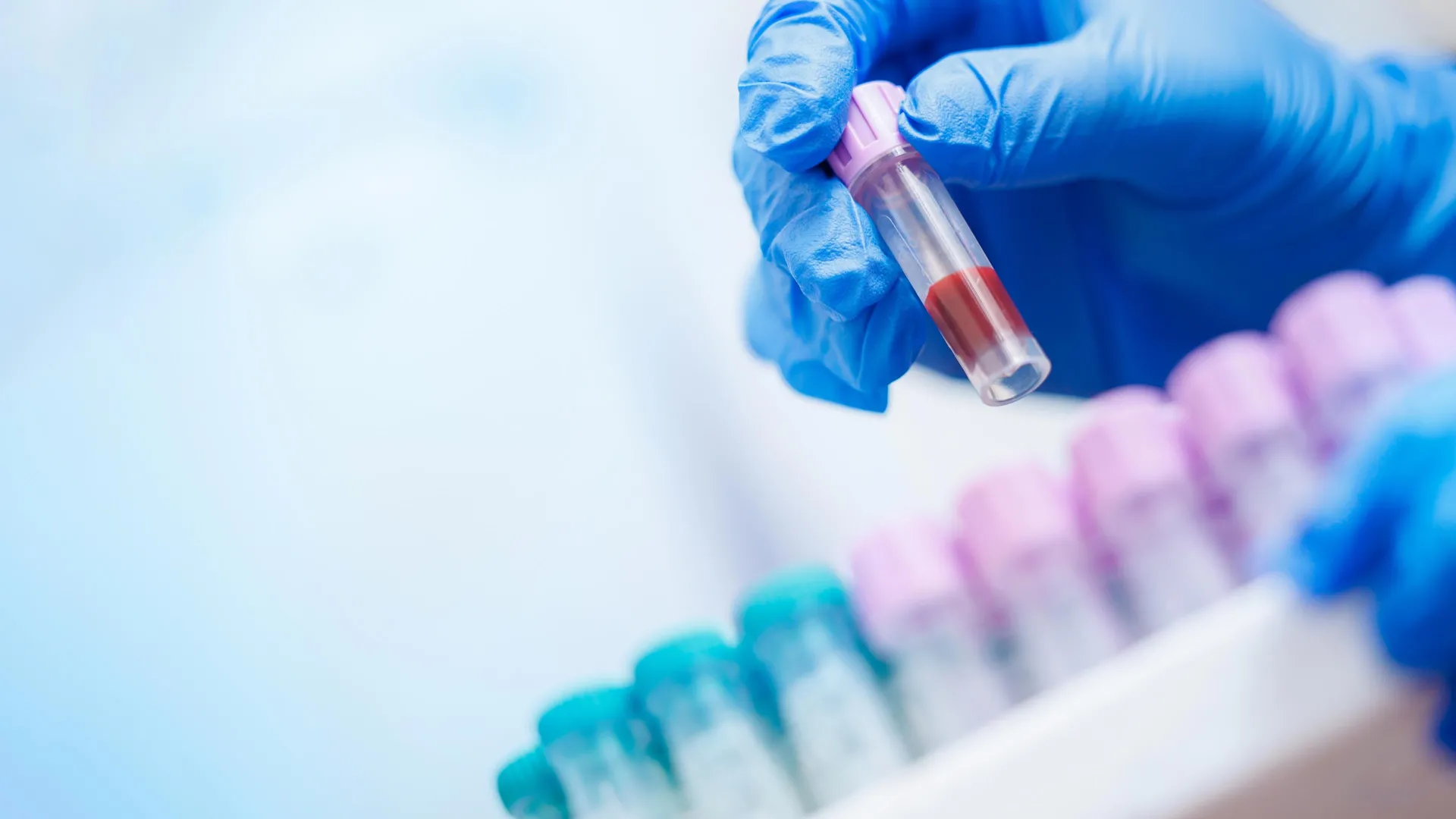 AI Analyzes Routine Blood Tests for Spinal Cord Injury Predictions